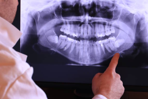 Best Emergency Tooth Extraction in Henderson, NC
