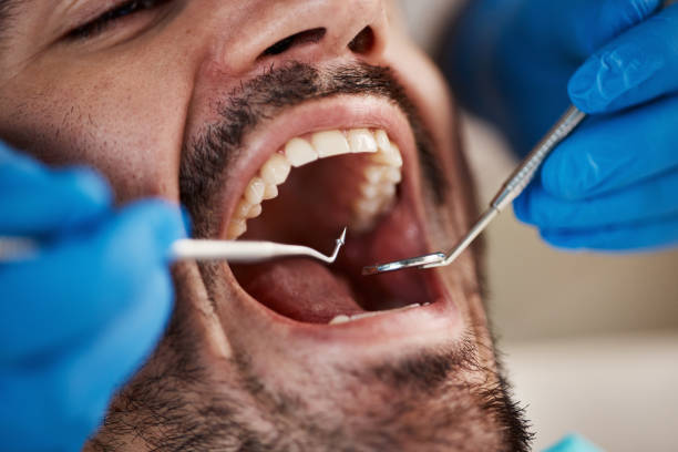Best Emergency Root Canal Treatment in Henderson, NC