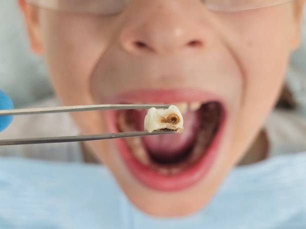 Best Pediatric Emergency Dentist in Henderson, NC